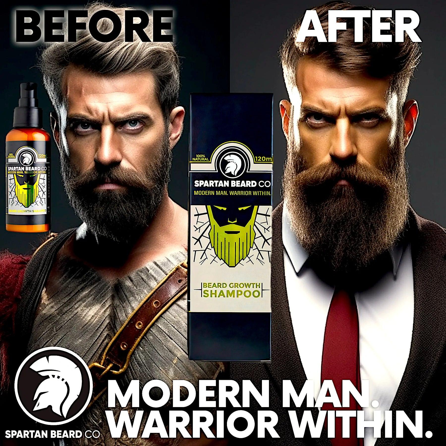 SPARTAN BEARD™ Growth Shampoo (Post-Checkout)